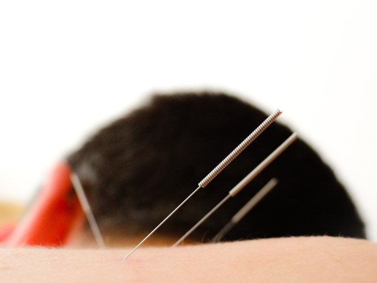 Vanessa Trevisan Acupuntura Asma