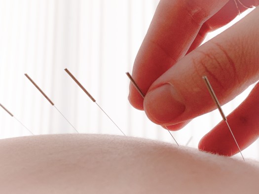 Vanessa Trevisan Acupuntura